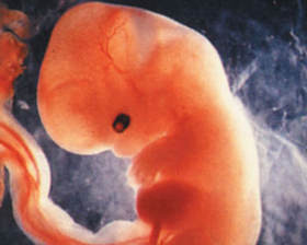Вид эмбриона на УЗИ