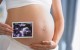 Прием в 23, 24 и 25 недели беременности в кабинете УЗ-диагностики